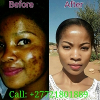 SANGOMA  【+27786380840】⓶   TRADITIONAL HEALER  In  Sandton , Siyabuswa , Somerset East , South Africa, Soweto , Springbok ,Springs , Tembisa , Thaba nchu , Thohoyandou , Tzaneen , Uitenhage , Ulundi , Umtata , Upington , Utrecht , Vanderbijlpark , Vereeniging ,Verulam , Vryheid , Wesselsbron , Westonaria , Westville , Worcester , Wynberg , zeerust